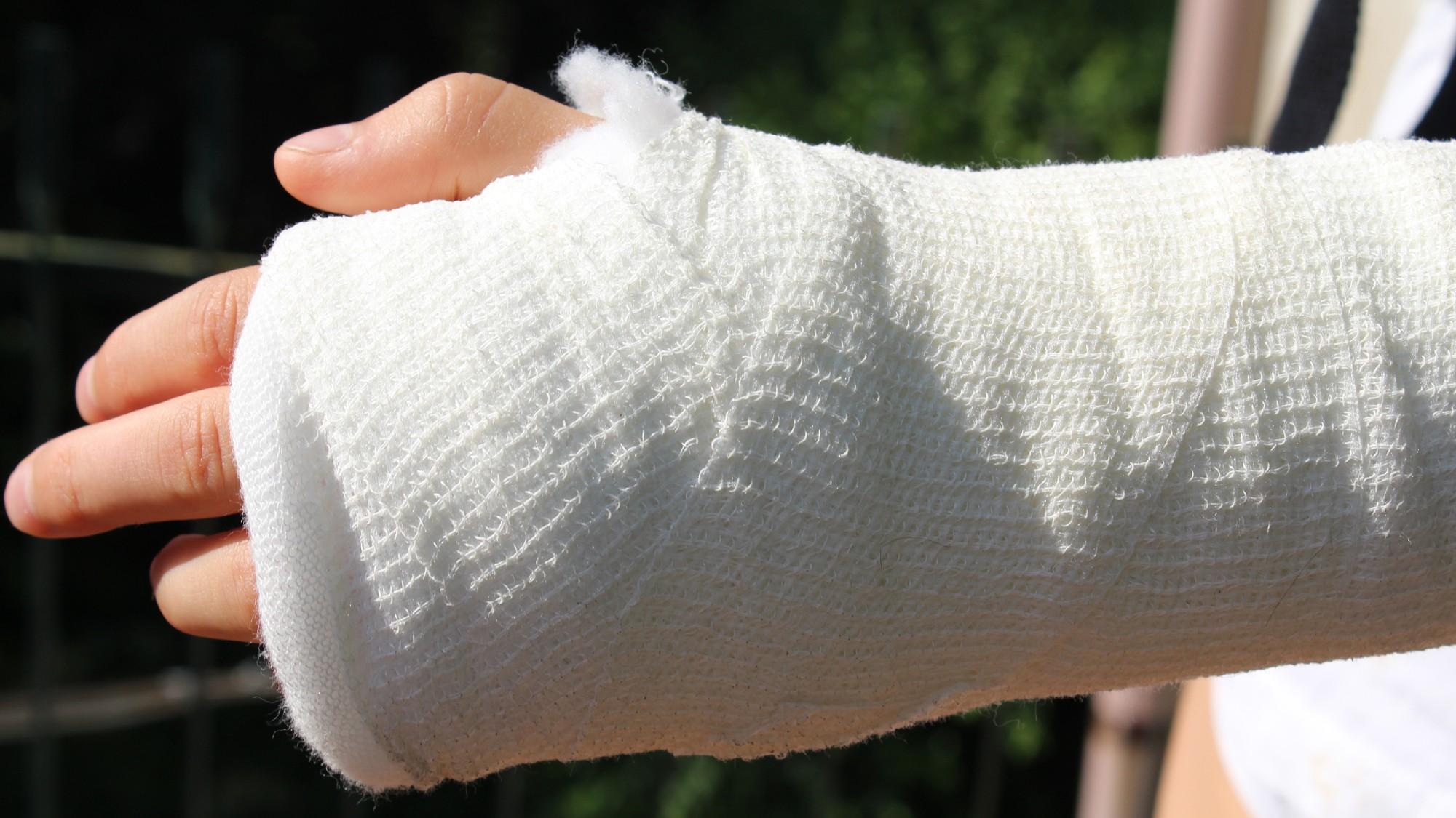 Ein Arm mit einem Gips