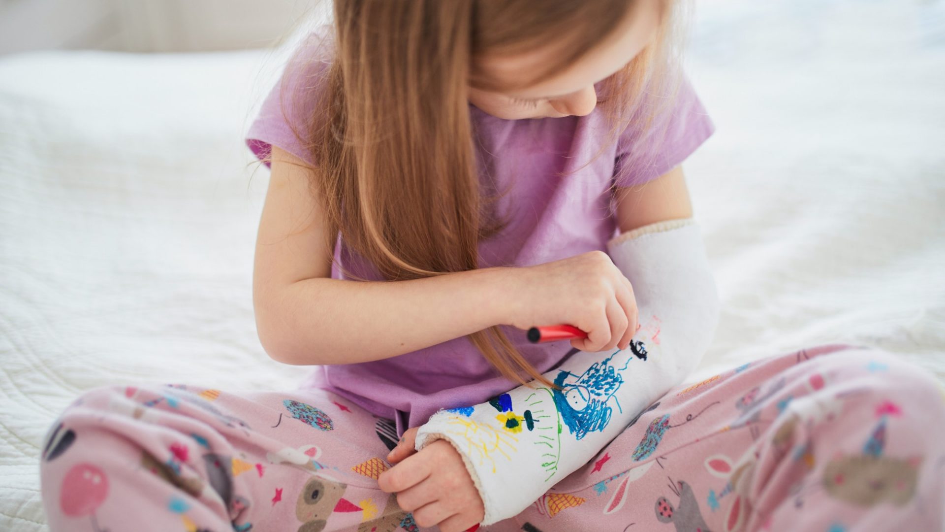 bimba con braccio ingessato che si colora il gesso